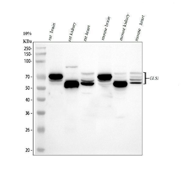 Western blot analysis of Glutaminase/GLS using anti-Glutaminase/GLS antibody (A01272-2)