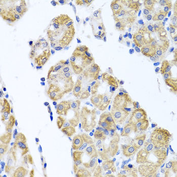 Immunofluorescence analysis of NIH/3T3 cells using Glutaminase  antibody  at dilution of 1:150