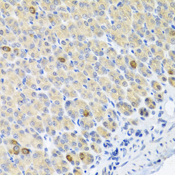 Immunofluorescence analysis of PC-12 cells using Glutaminase  antibody  at dilution of 1:150