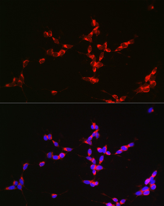a01272 gls primary antiboties if testing 4