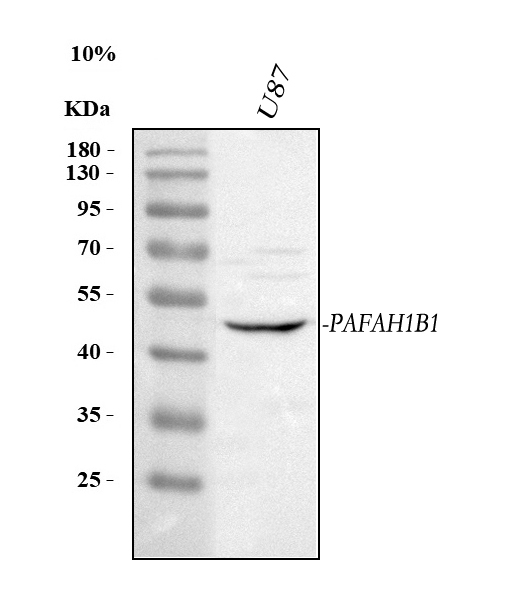  Western blot analysis of LIS1/PAFAH1B1 using anti-LIS1/PAFAH1B1 antibody (A01273-1)