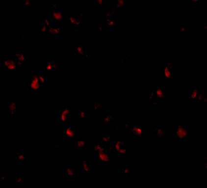 a01273 pafah1b1 primary antibodies if testing 3