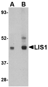 a01273 pafah1b1 primary antibodies wb testing 1