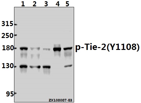 Western blot (WB) analysis of p-Tie-2 (Y1108) pAb at 1:2000 dilution
Lane1:A549 whole cell lysate(40ug)
Lane2:A375 whole cell lysate(40ug)
Lane3:SGC7901 whole cell lysate(40ug)
Lane4:H9C2 whole cell lysate(40ug)
Lane5:AML-12 whole cell lysate(40ug)