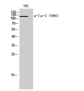 Western Blot analysis of VEC cells using Phospho-Tie-2 (Y992) Polyclonal Antibody