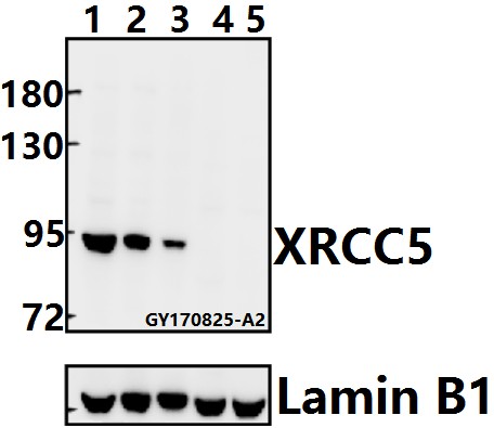 Western blot (WB) analysis of XRCC5 (S462) pAb at 1:500 dilution
Lane1:PC3 whole cell lysate(40ug)
Lane2:A549 whole cell lysate(20ug)
Lane3:SK-OVCAR3 whole cell lysate(20ug)
Lane4:The Testis tissue lysate of Mouse(40ug)
Lane5:The Testis tissue lysate of Rat(40ug)