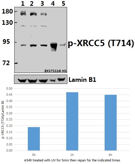 Western blot (WB) analysis of p-XRCC5 (T714) pAb at 1:500 dilution
Lane1:A549 whole cell lysate(40ug)
Lane2:A549 treated with UV for 5 minutes then repair for 1 hour whole cell lysate(40ug)
Lane3:A549 treated with UV for 5 minutes then repair for 6 hours whole cell lysate(40ug)
Lane4:The Brain tissue lysate of Mouse(40ug)
Lane5:The Uterus tissue lysate of Rat(40ug)