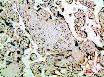 Immunohistochemical analysis of paraffin-embedded human-placenta, antibody was diluted at 1:200