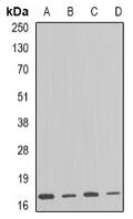 Western blot analysis of ARF1 expression in HT29 (A), SKOV3 (B), mouse brain (C), rat liver (D) whole cell lysates