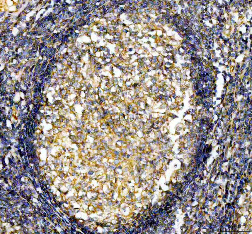 a01281 2 tapa1 primary antibodies ihc testing 2_1