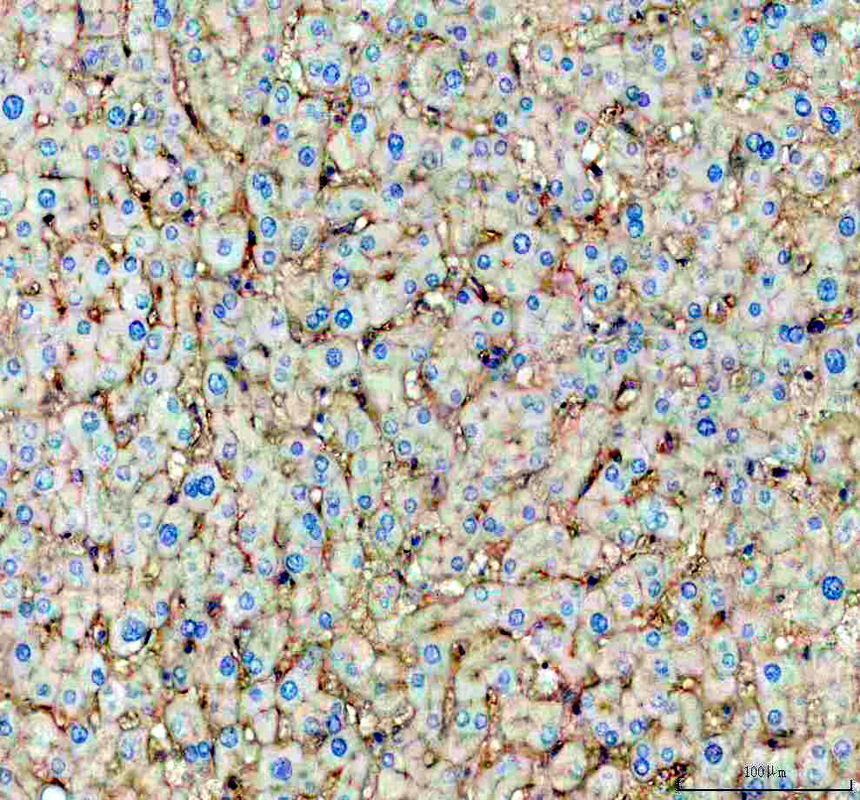 a01281 2 tapa1 primary antibodies ihc testing 3