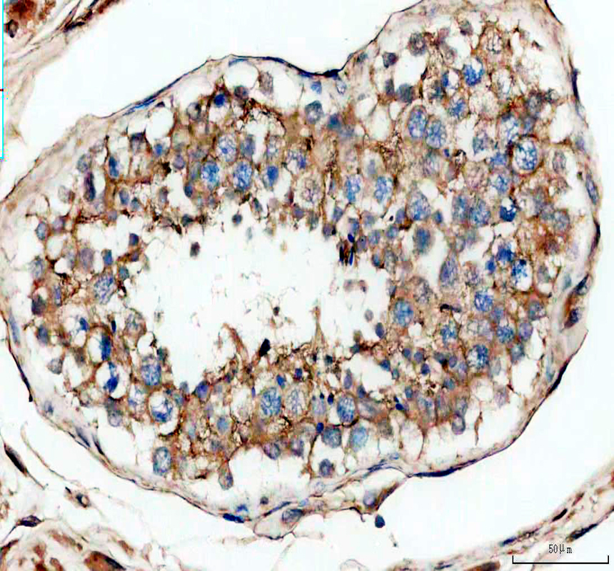 a01281 2 tapa1 primary antibodies ihc testing 4