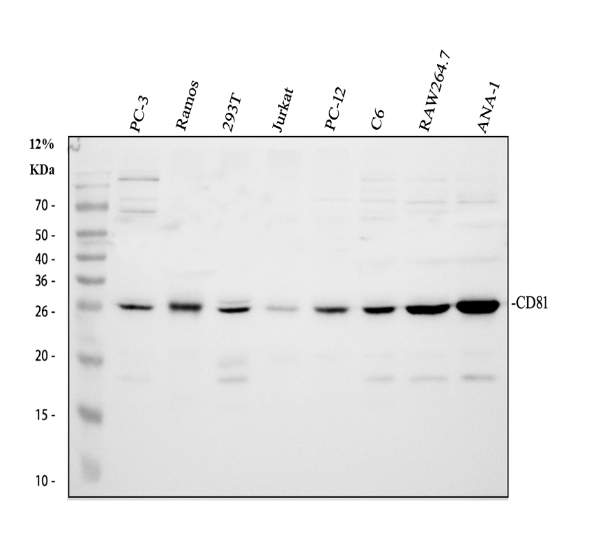 Western blot analysis of TAPA1 using anti-TAPA1 antibody (A01281-2)