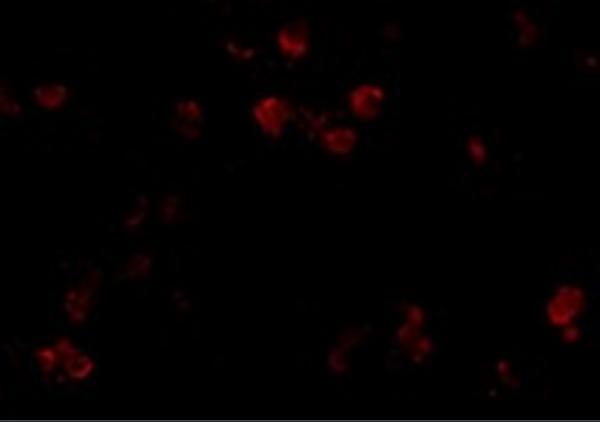 Immunofluorescence of CD81 in A549 cells with CD81 antibody at 20 μg/mL