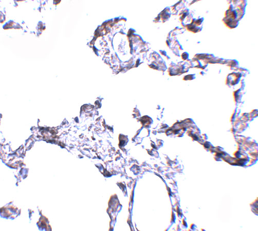 Immunohistochemistry of CD81 in human lung tissue with CD81 antibody at 5 μg/mL