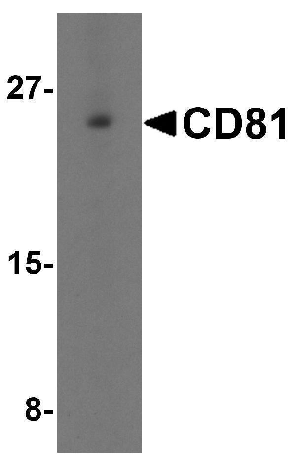 Western blot analysis of CD81 in human lung tissue lysate with CD81 antibody at 1 μg/mL in (A) the absence and (B) the presence of blocking petide