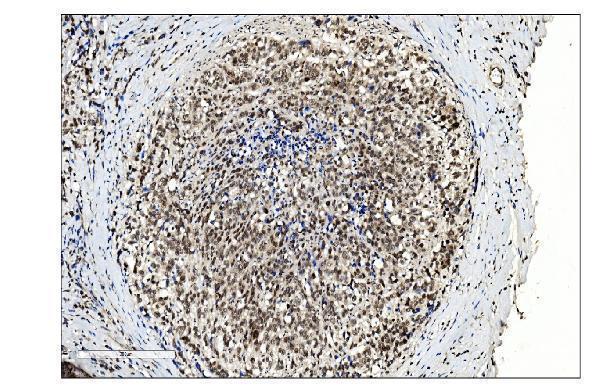  IHC analysis of SUMO2/3 using anti-SUMO2/3 antibody (A01282-2)