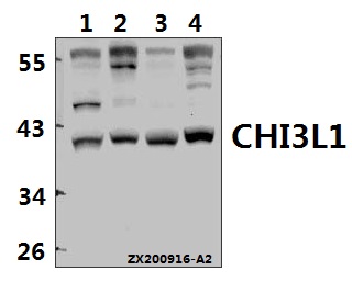 Western blot (WB) analysis of CHI3L1 pAb at 1:500 dilution
Lane1:U-87MG whole cell lysate(40ug)
Lane2:L02 whole cell lysate(40ug)
Lane3:AML-12 whole cell lysate(40ug)
Lane4:C6 whole cell lysate(40ug)