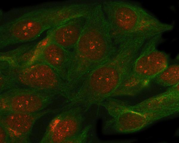 a01285 smc5 primary antibodies if testing 2