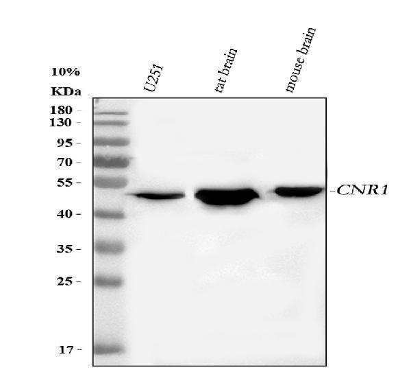  Western blot analysis of Cannabinoid Receptor 1/CNR1 using anti-Cannabinoid Receptor 1/CNR1 antibody (A01291-2)