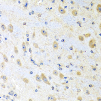 a01292 mln primary antiboties ihc testing 3