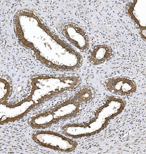 a01293 3 prkcq primary antibodies ihc testing 2