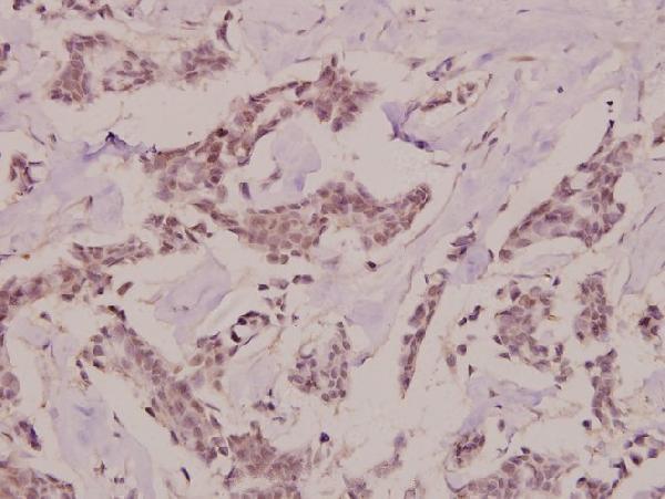 a01293 prkcq primary antiboties ihc testing 2