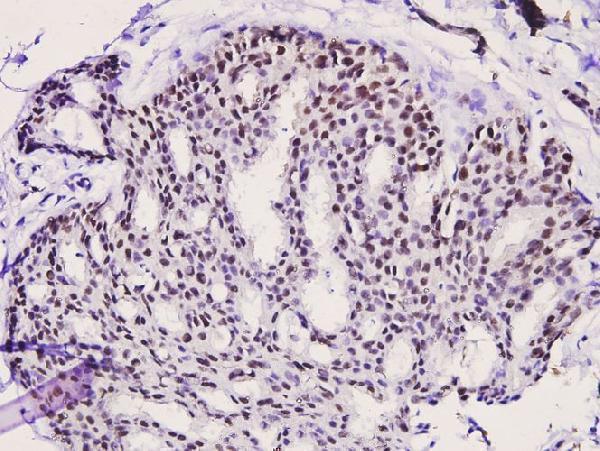a01293s676 prkcq primary antiboties ihc testing 2