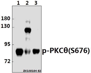 a01293s676 prkcq primary antiboties wb testing 1