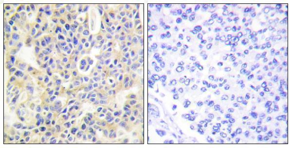 a01293s695 prkcq primary antibodies ihc testing 3