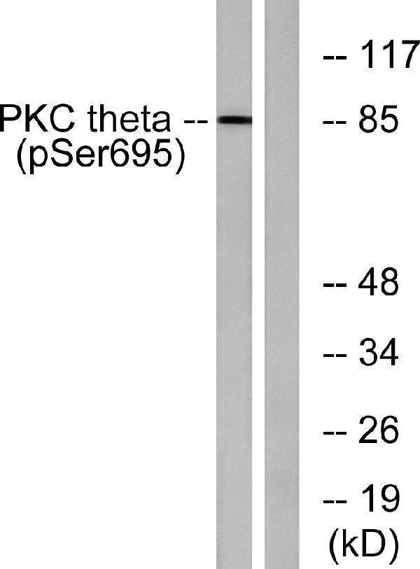 a01293s695 prkcq primary antibodies wb testing 2