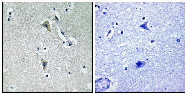 a01293t538 1 prkcq primary antibodies ihc testing 1