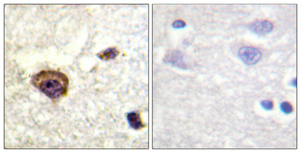 a01293t538 1 prkcq primary antibodies ihc testing 3