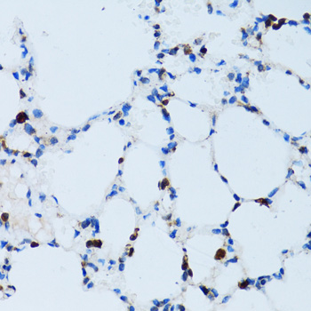 Immunohistochemistry of paraffin-embedded mouse lung using SPN antibody  at dilution of 1:100 