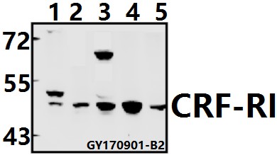 Western blot (WB) analysis of CRF-RI (H177) pAb at 1:1000 dilution
Lane1:L02 whole cell lysate(20ug)
Lane2:MCF-7 whole cell lysate(20ug)
Lane3:A549 whole cell lysate(40ug)
Lane4:C6 whole cell lysate(40ug)
Lane5:BV2 whole cell lysate(40ug)