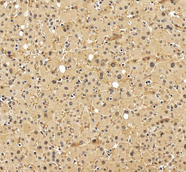 IHC analysis of RXRA using anti-RXRA antibody (A01299-1)