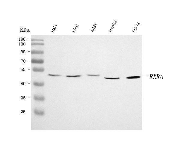  Western blot analysis of RXRA using anti-RXRA antibody (A01299-2)