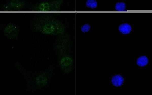 ICC staining Retinoid X Receptor alpha in A549 cells (green)