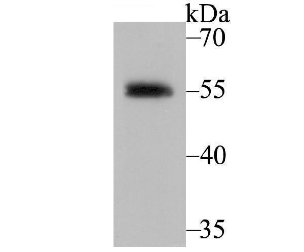 Western blot analysis of Retinoid X Receptor alpha on MCF-7 cell using anti-Retinoid X Receptor alpha antibody at 1/5,000 dilution
