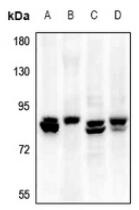 Western blot analysis of ELN expression in rat lung (A), mouse lung (B), A375 (C), A549 (D) whole cell lysates
