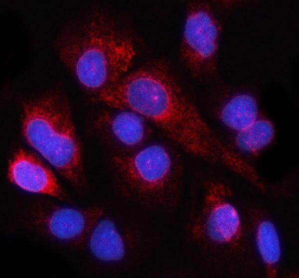 a01301 1 nup98 primary antibodies if testing 2