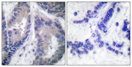 a01302 2 col18a1 primary antibodyes ihc testing 1