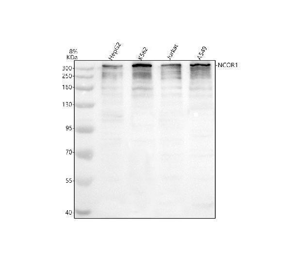 Western blot analysis of NCOR1 using anti-NCOR1 antibody (A01304-2)