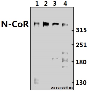 Western blot (WB) analysis of N-CoR (H76) pAb at 1:500 dilution
Lane1:CT26 whole cell lysate(40ug)
Lane2:C6 whole cell lysate(40ug)
Lane3:HepG2 whole cell lysate(40ug)
Lane4:Hela whole cell lysate(40ug)