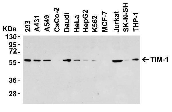 Western Blot Validation in Human Cell Lines
Loading: 15 μg of lysates per lane