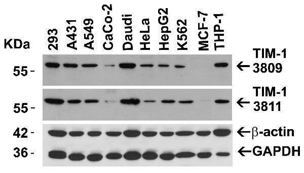 Independent Antibody Validation (IAV) via Protein Expression Profile in Cell Lines
Loading: 15 μg of lysates per lane