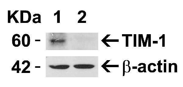 Validation with TIM-1 siRNA Knockdown in Hela Cells
HeLa cells were transfected with control siRNAs (lane 1) or TIM-1 siRNAs (lane 2) 
Loading: 15 μg of HeLa whole cell lysates per lane