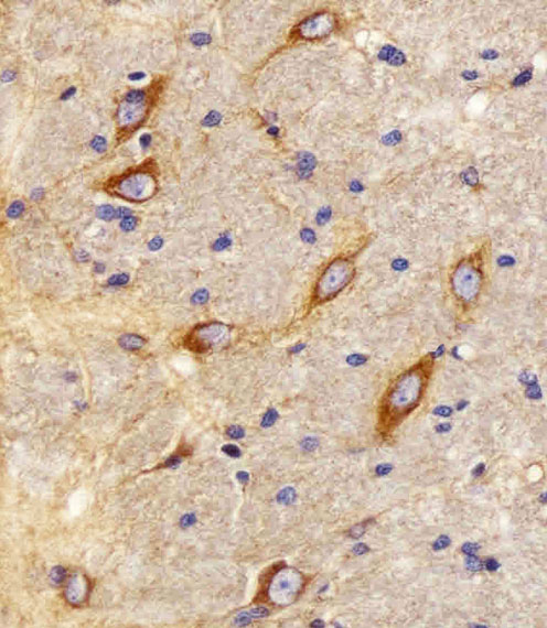 Immunohistochemical analysis of paraffin-embedded R. brain section using CB2 Antibody(C-term). A01307-3 was diluted at 1:25 dilution. A peroxidase-conjugated goat anti-rabbit IgG at 1:400 dilution was used as the secondary antibody, followed by DAB staining.