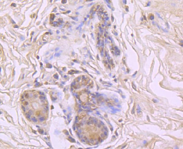 a01308 1 ppia primary antiboties ihc testing 2