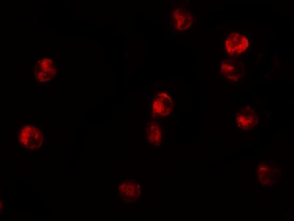 a01309 kdm6b primary antibodies if testing 8